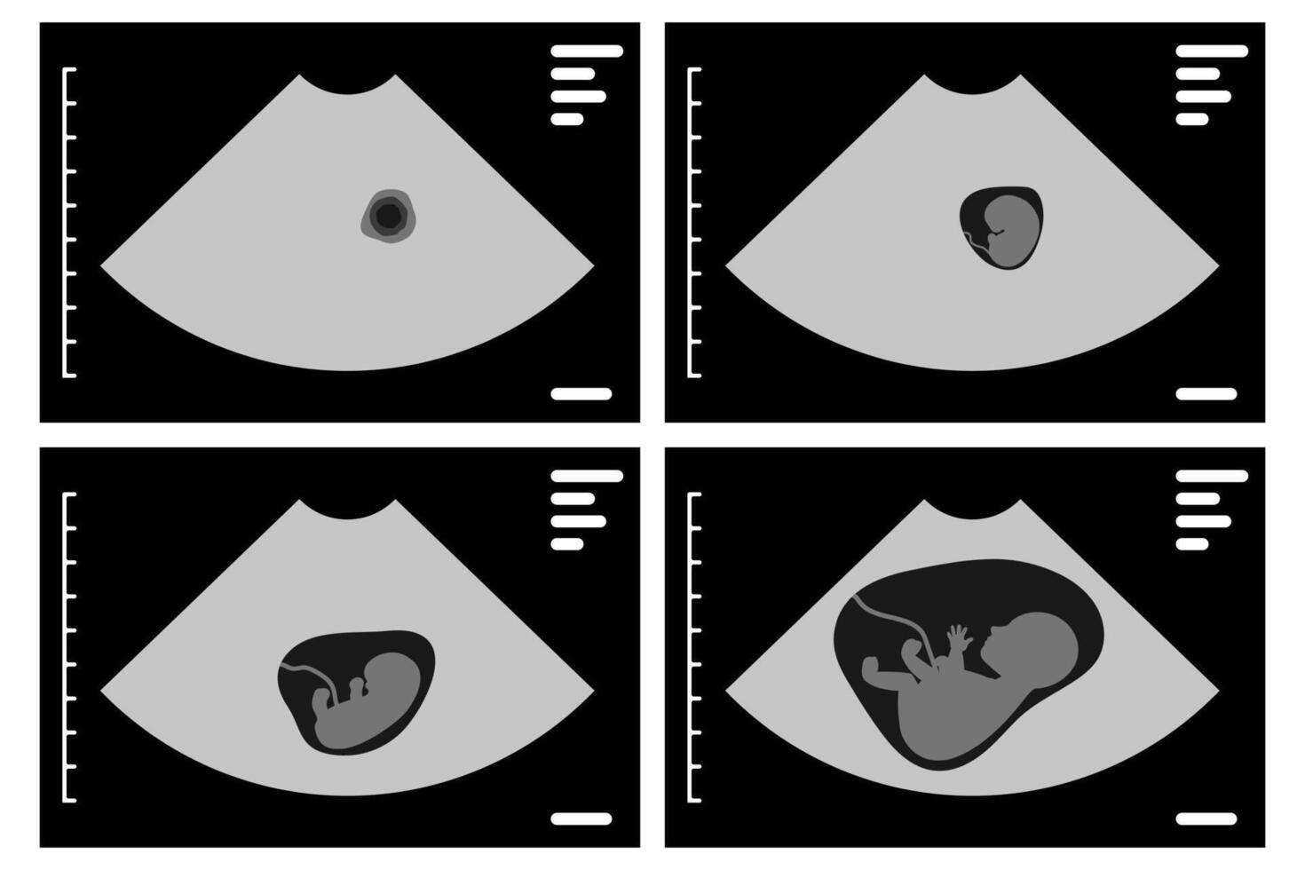 Ultrasound images showing fetal development during pregnancy vector