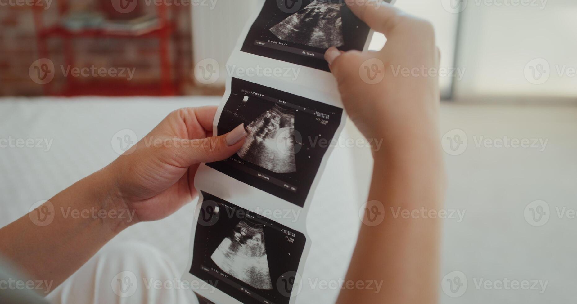 A woman examines ultrasound images sitting on a bed at home, close-up of her hands, no face photo