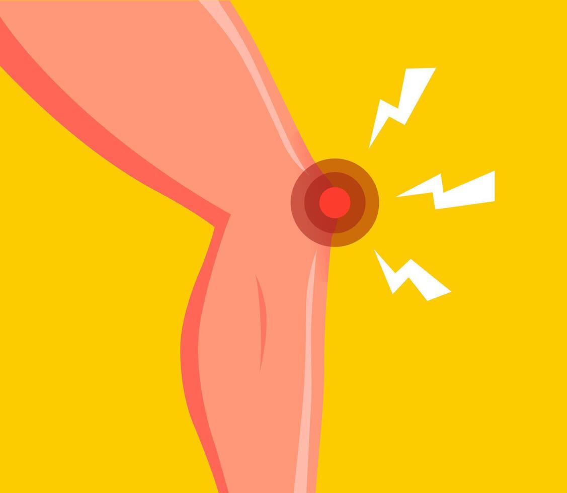 Knee pain in a person. Sore joint in the leg. vector