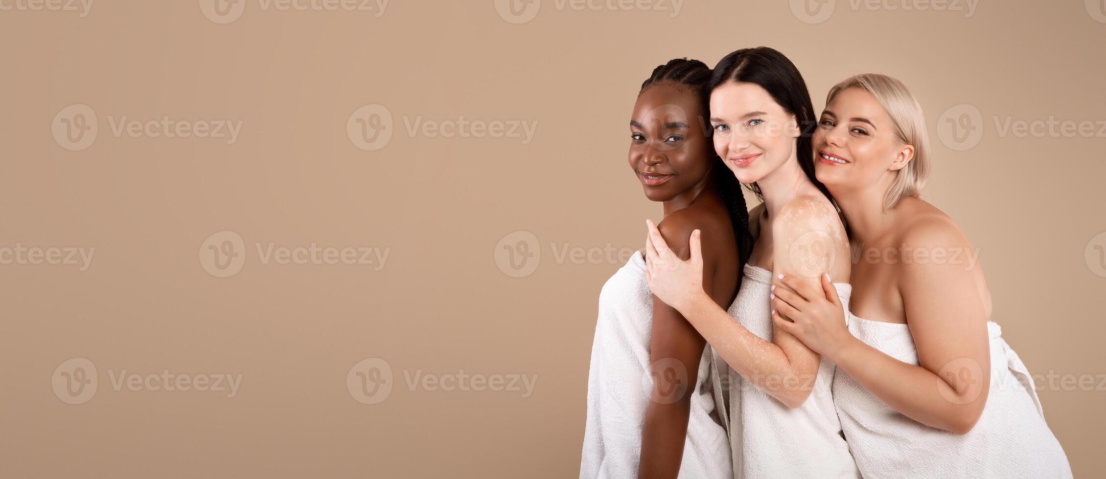 Beauty Diversity. Three Multi-Ethnic Women With Different Types Of Skin And Body Sizes Posing Wrapped In Towels Over Beige Background, Positive Young Females Embracing And Smiling At Camera photo