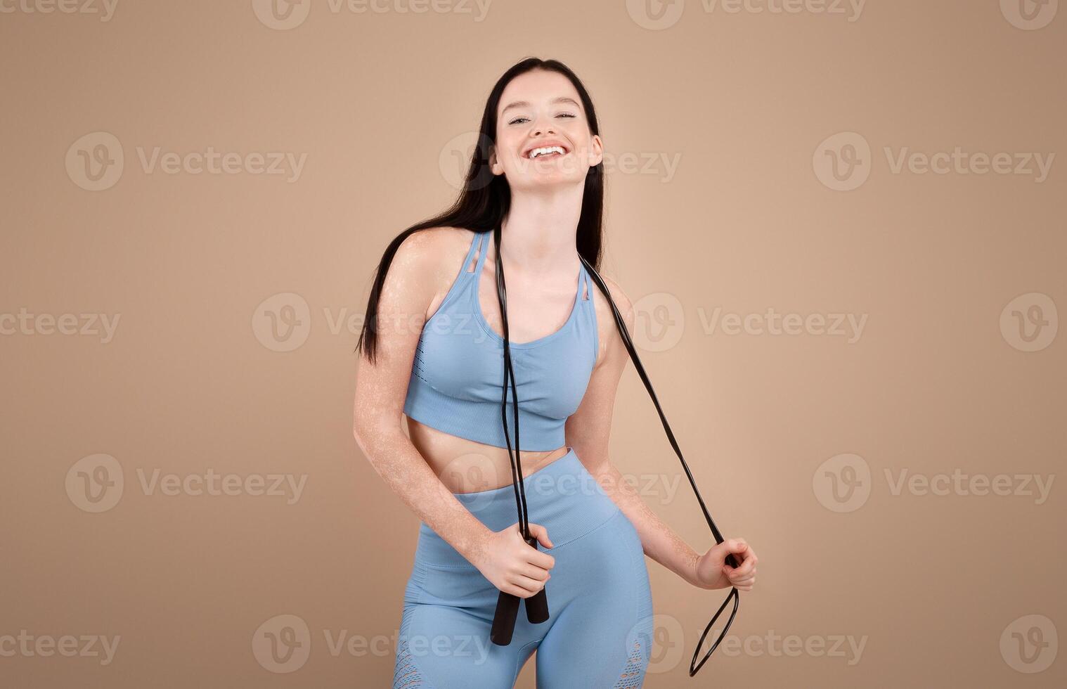 Fitness Concept. Portrait Of Cheerful Sporty Woman With Vitiligo Disorder Holding Jump Rope, Smiling At Camera, Fit Young Lady In Sportswear Posing Over Beige Studio Background, Copy Space photo