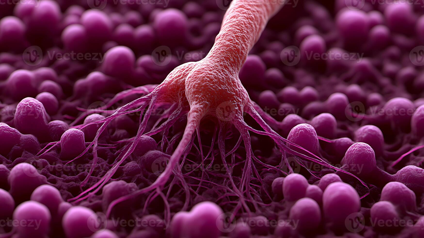 Microscopic View of Cancer Cell Invading Healthy Tissue with Metastasis photo