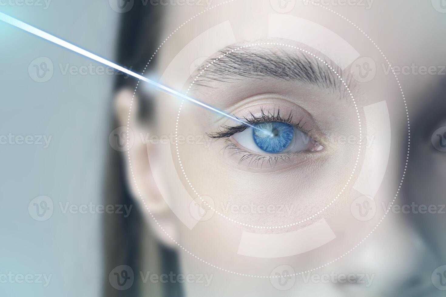 Close-up of blue eye undergoing medical procedure in a clinical setting showing technology and precision used for eye care photo