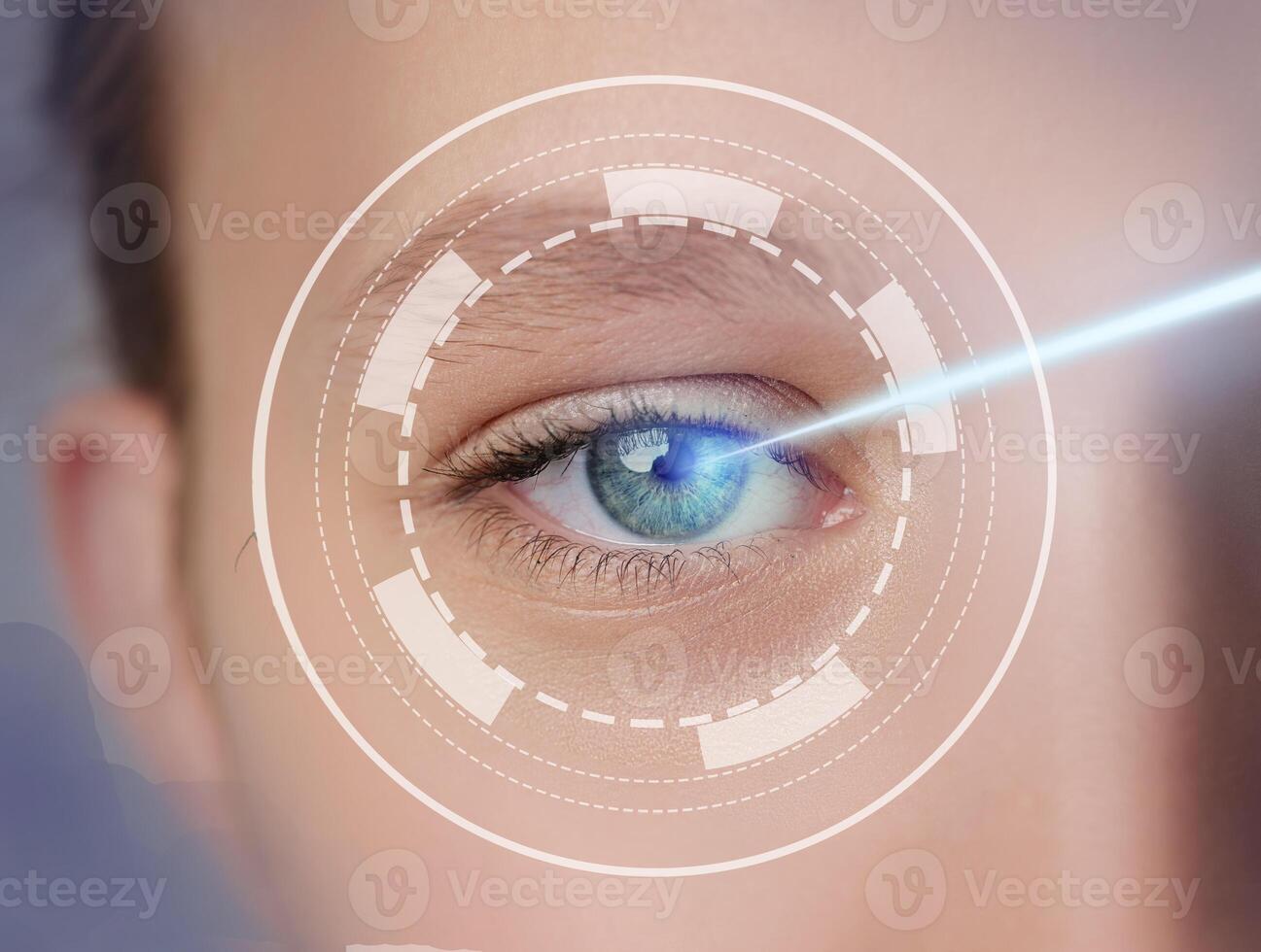 High-tech eye treatment in a modern clinic during a daytime session with advanced equipment photo