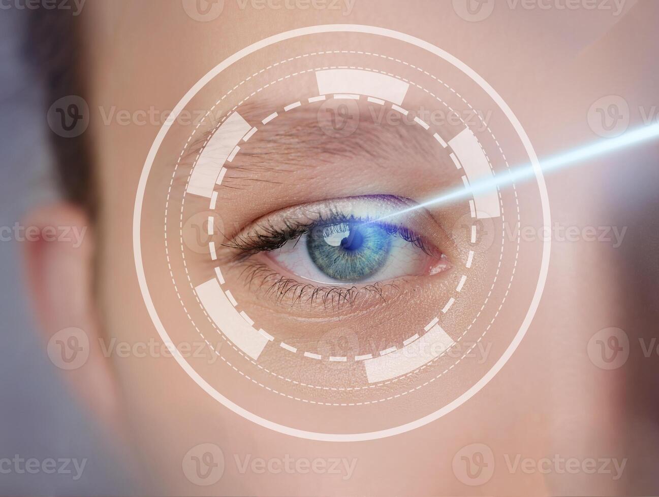 Advanced laser technology enhances vision through precision treatment in a clinical setting photo