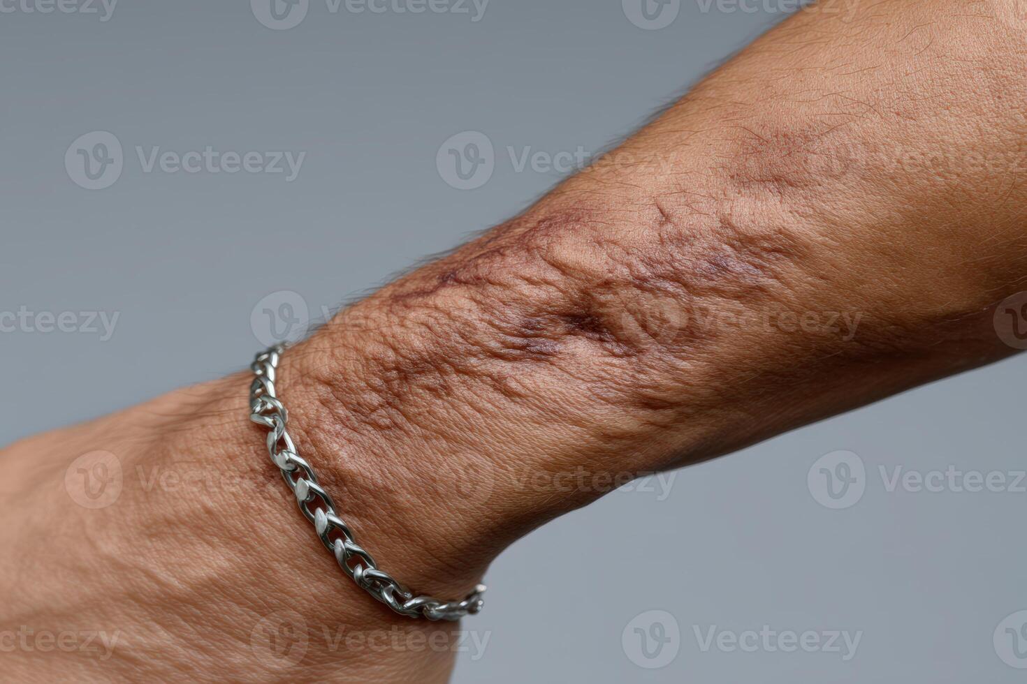 Person's forearm showing prominent scars and skin texture under studio lighting photo