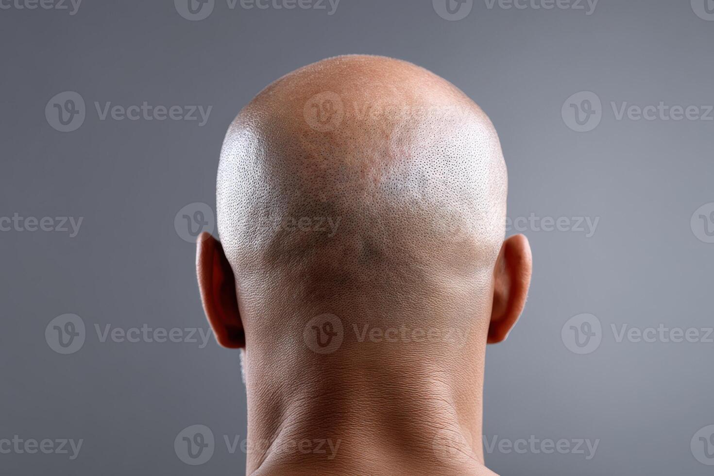 Close view of a bald man's head showing smooth scalp and neck in a neutral backdrop photo
