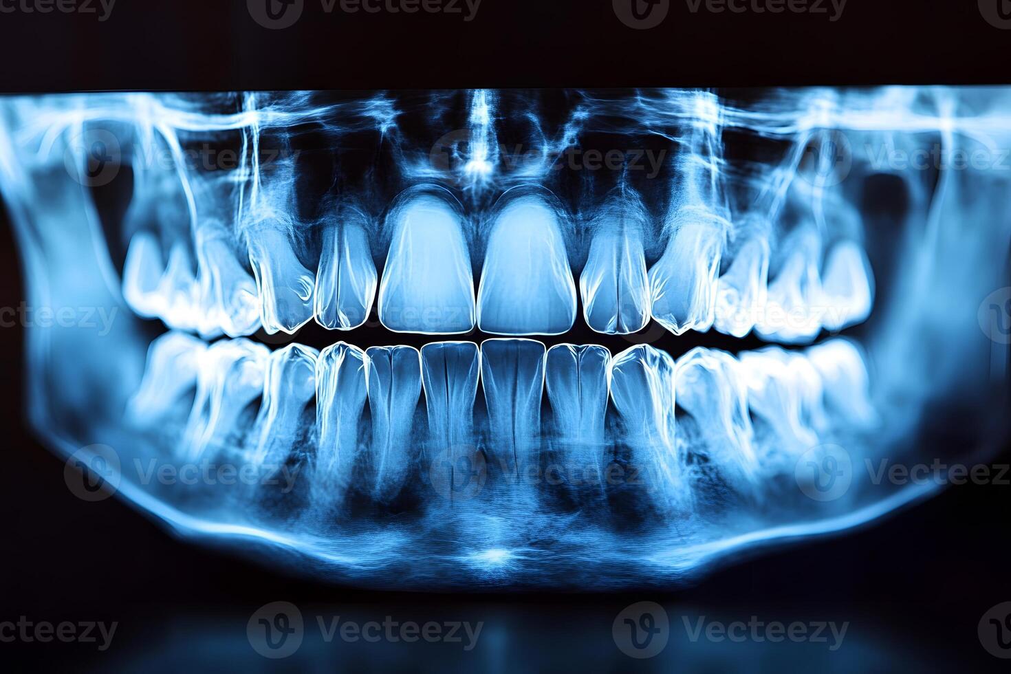 Panoramic Dental X-Ray for Oral Health Assessment and Diagnosis photo