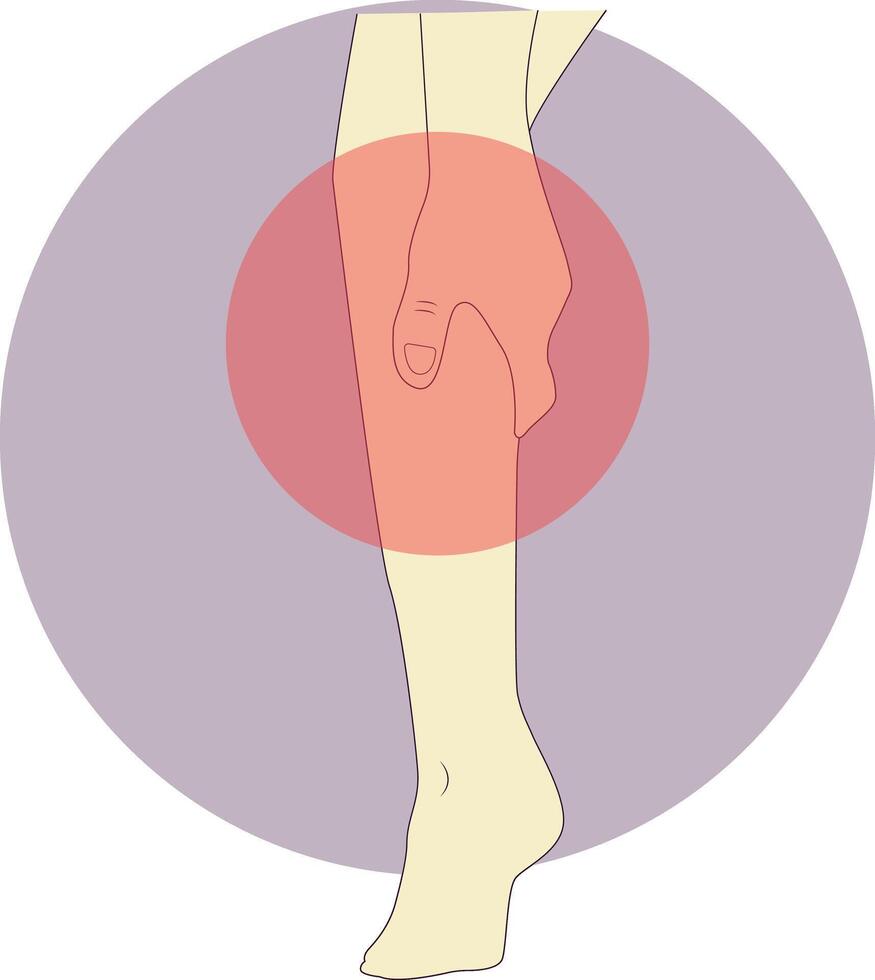 Pain on Hand and Leg Illustration, Isolated on White Background vector