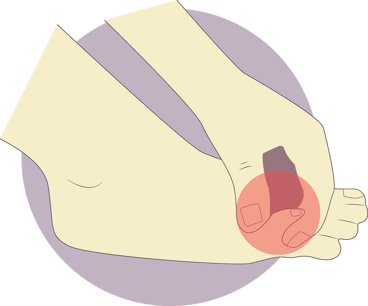 Pain on Hand and Leg Illustration in Cartoon Concept vector
