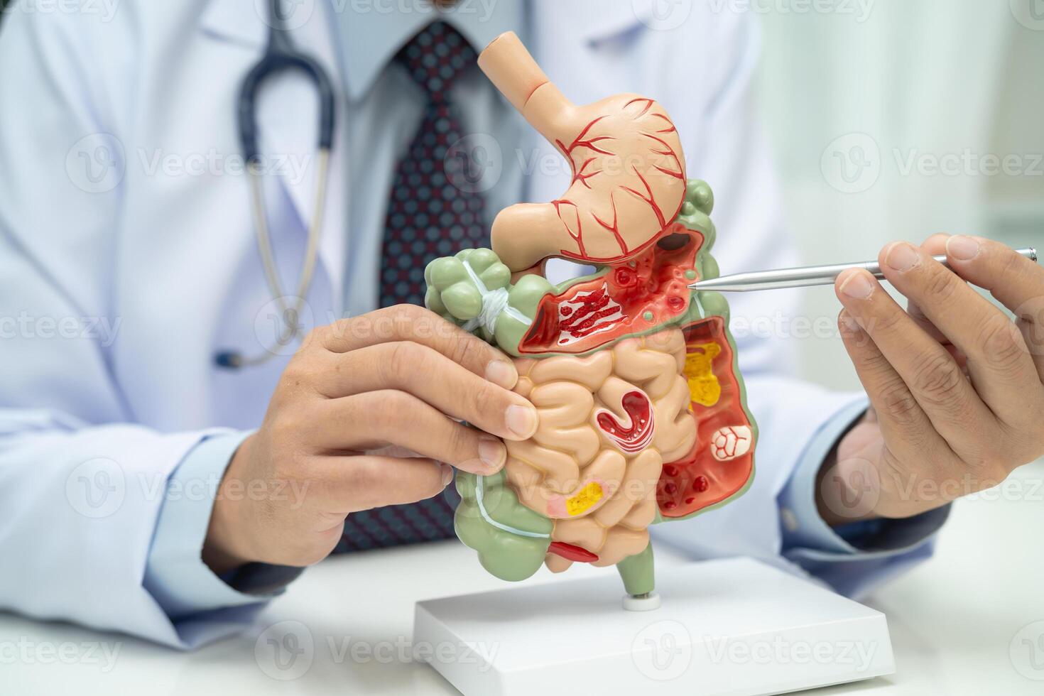 Digestive system with stomach and intestine photo