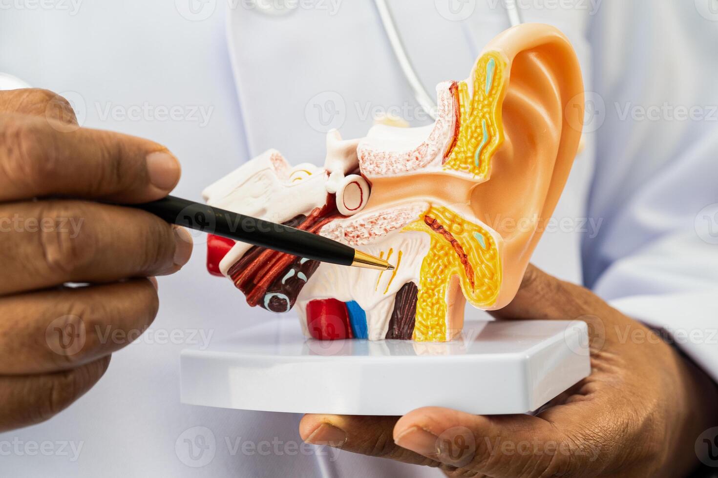 doctor holding human ear model to learn and treat hearing loss photo