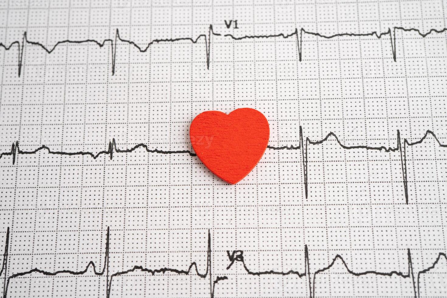 Red heart on electrocardiogram ECG with red heart, heart wave heart attack photo