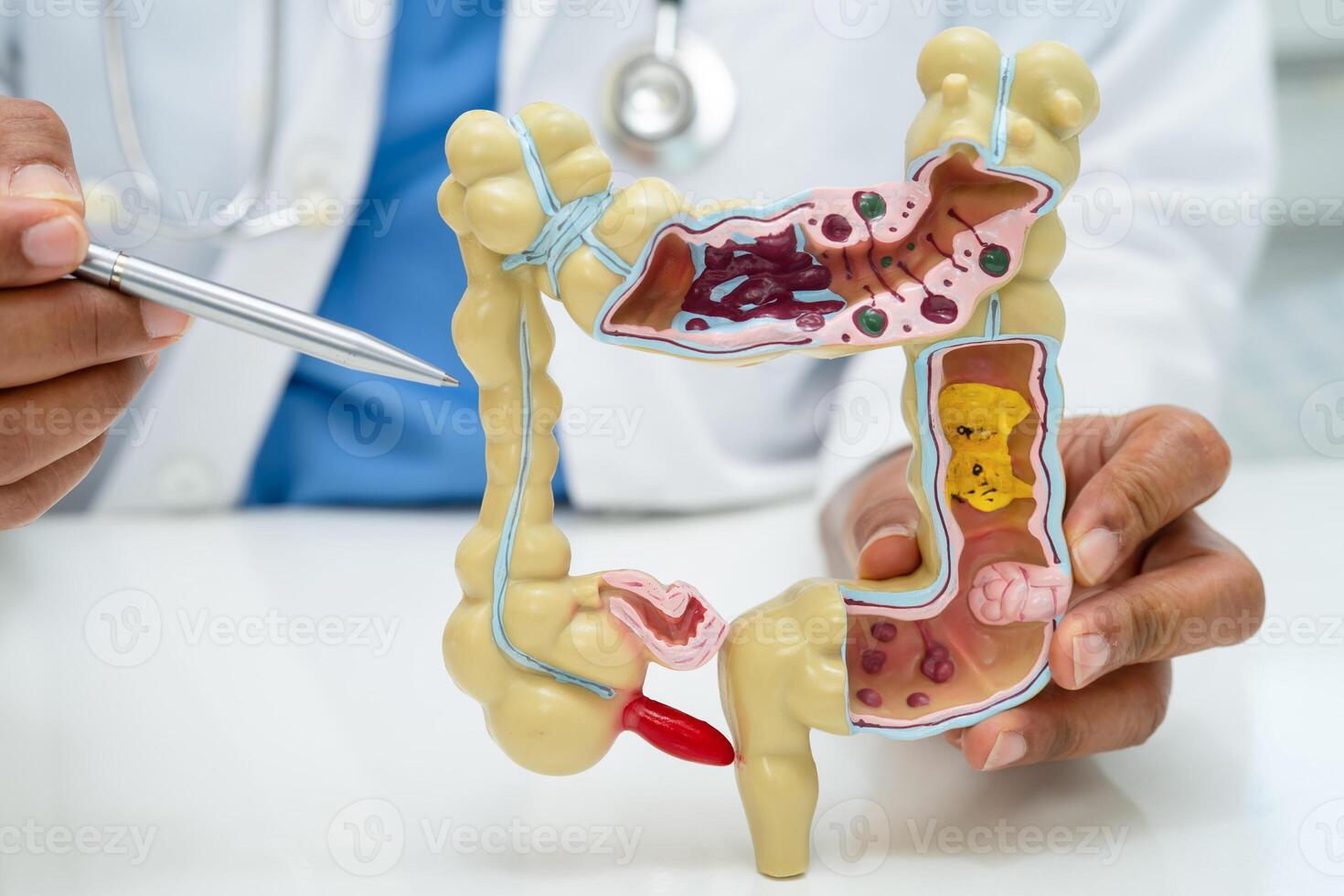 Intestine appendix and digestive system photo