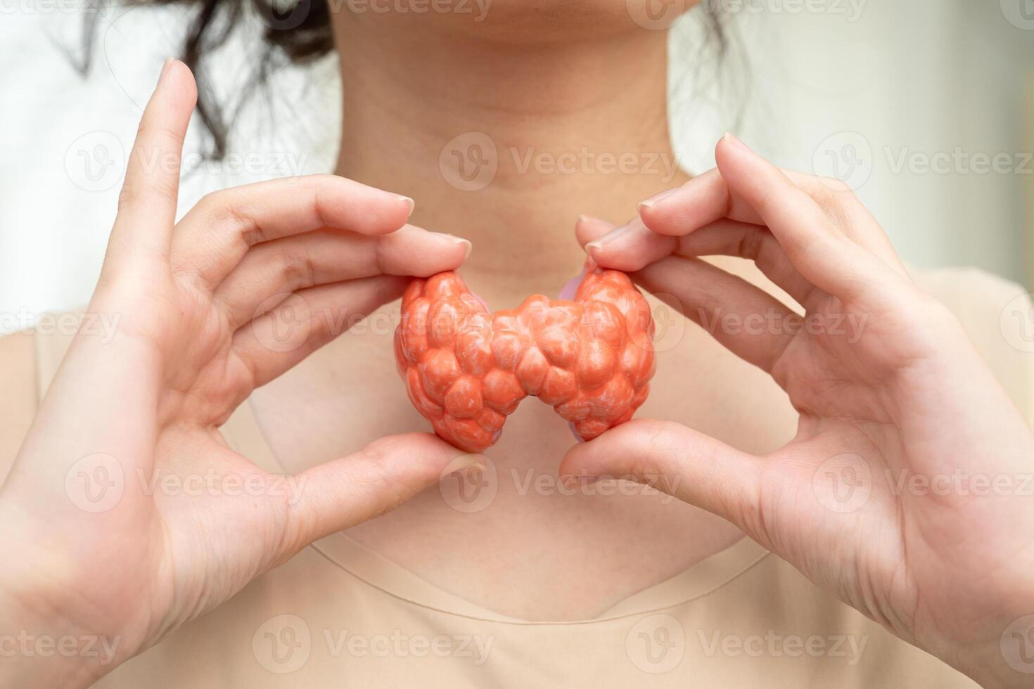 Hyperthyroidism Overactive Thyroid, Thyroid Lymphoma, Asian woman with thyroid gland photo