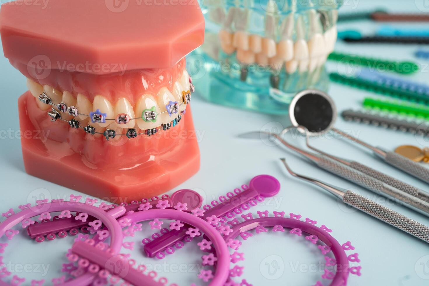 Orthodontic ligatures rings and ties, elastic rubber bands on orthodontic braces, model for dentist studying photo