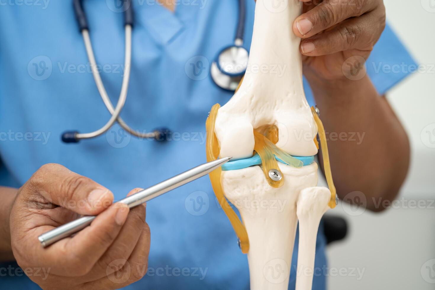 Osteoarthritis of the knee, Doctor holding human knee joint photo