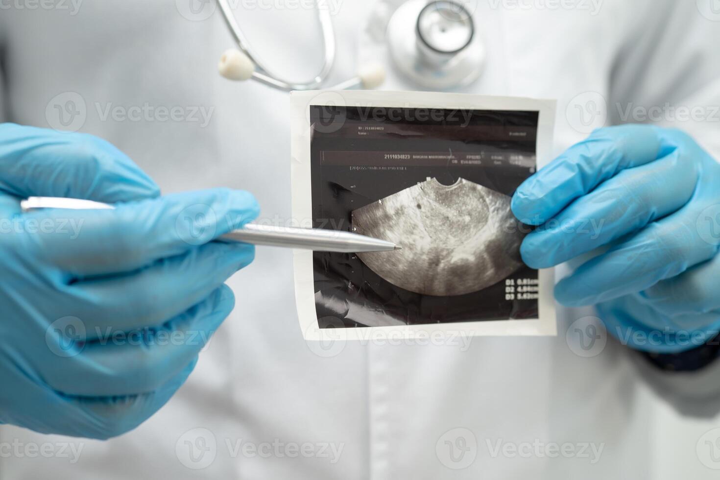 Uterus and ovary, doctor holding anatomy model and ultrasound picture for study diagnosis photo