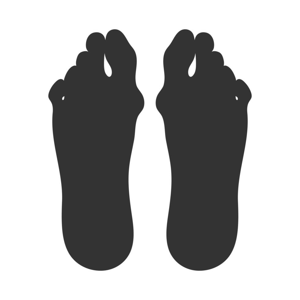 Silhouette of feet sole with a Hallux valgus deformation. Bunion of a big toe vector