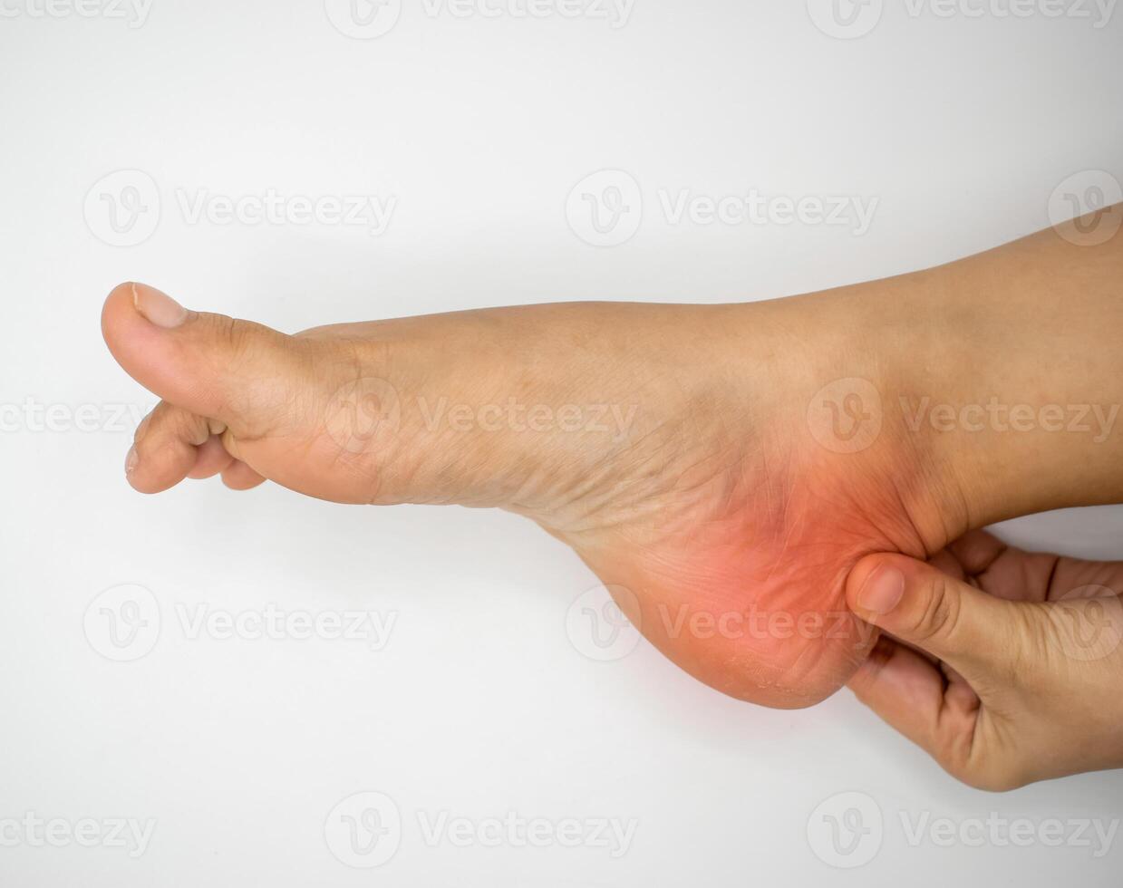 Experiencing Heel Pain, A Common Foot Discomfort Issue photo