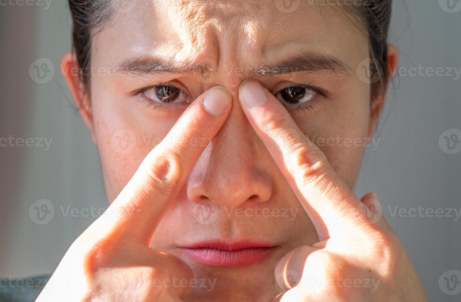 Portrait of unhappy Asian woman pointing to an acne occur between her eyebrows. photo