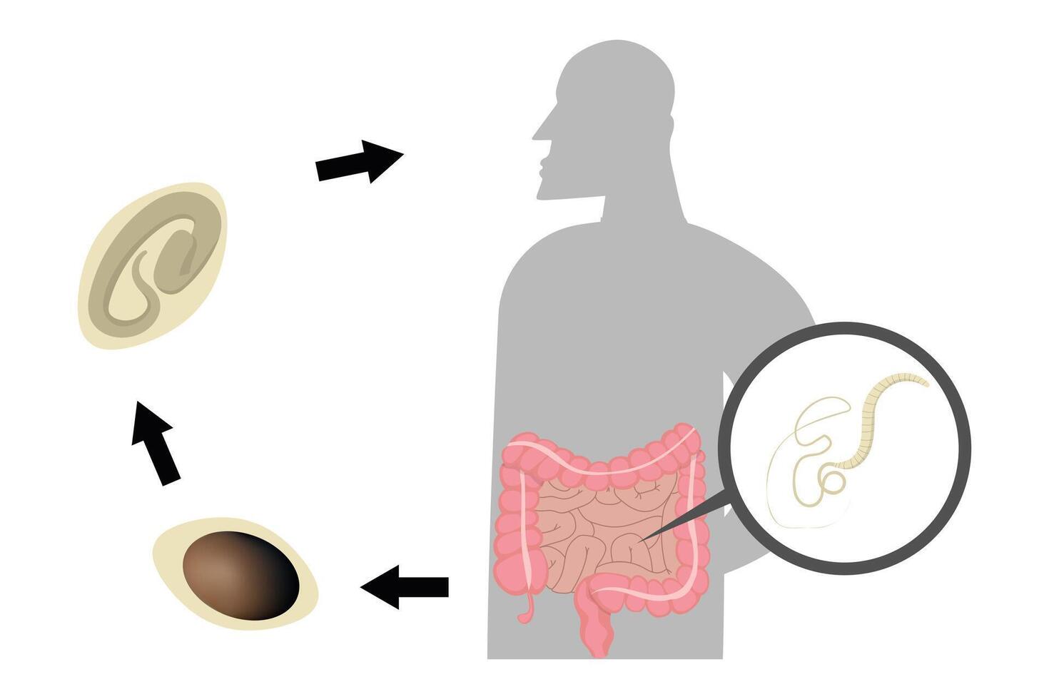 Whipworm lifecycle showing the infection of human intestine by trichuris trichiura vector