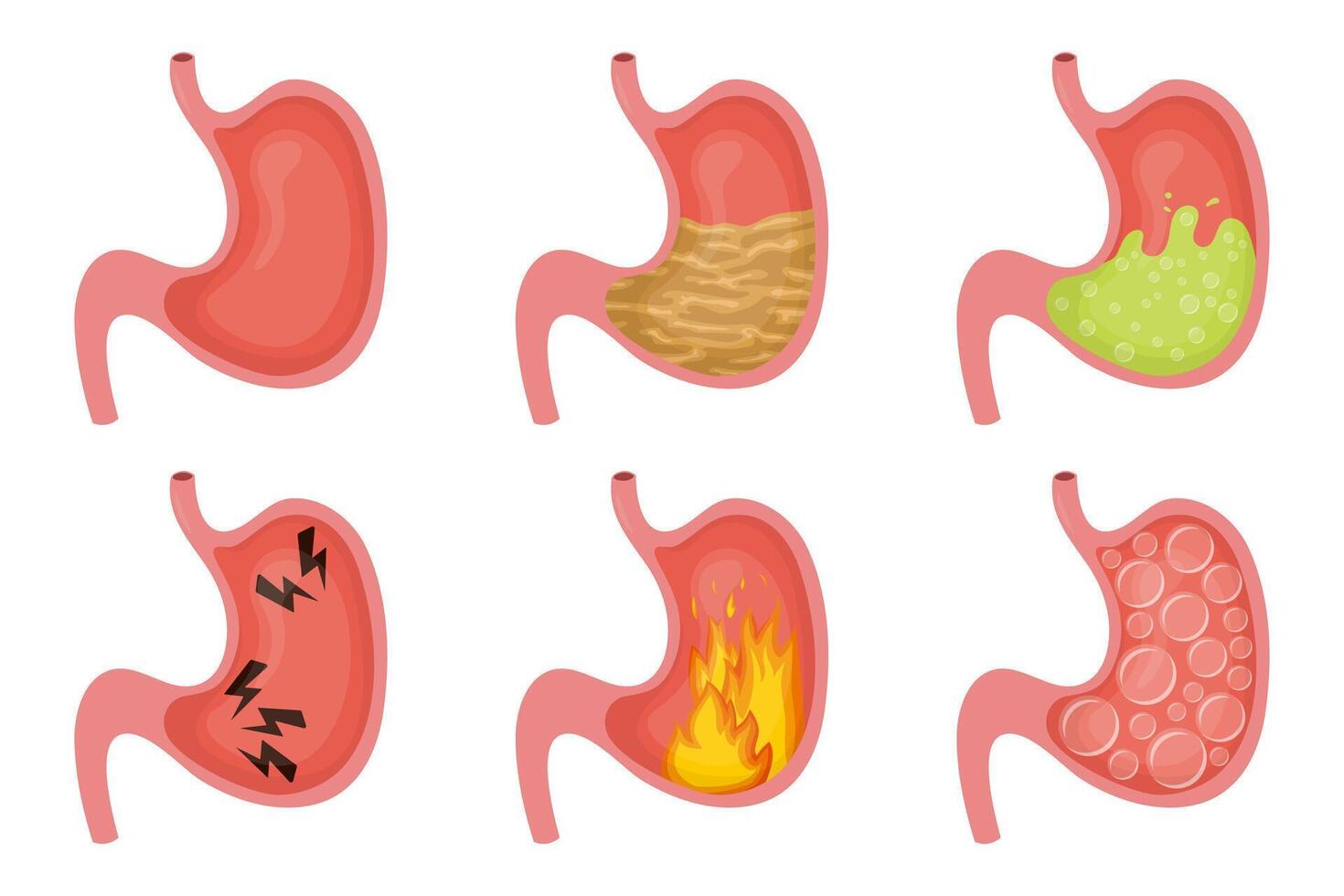 Human stomach showing different symptoms and diseases, including heartburn, bloating, and vomiting vector