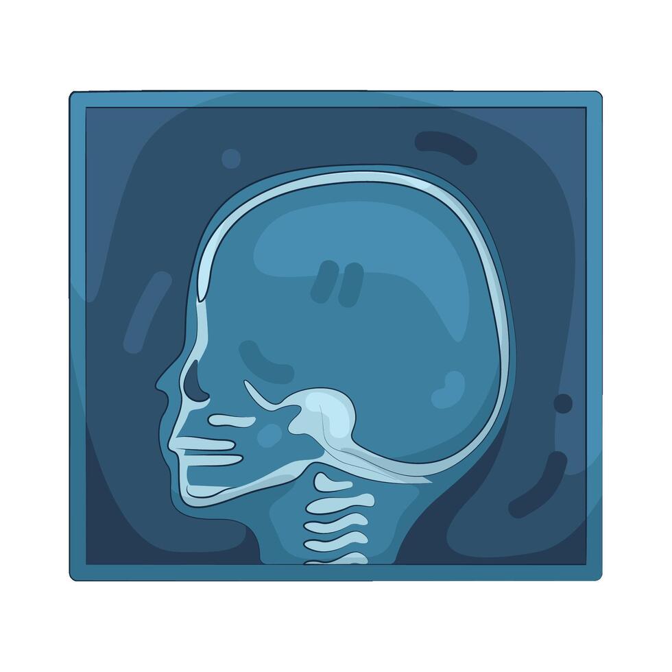 Illustration of Bone X-ray vector