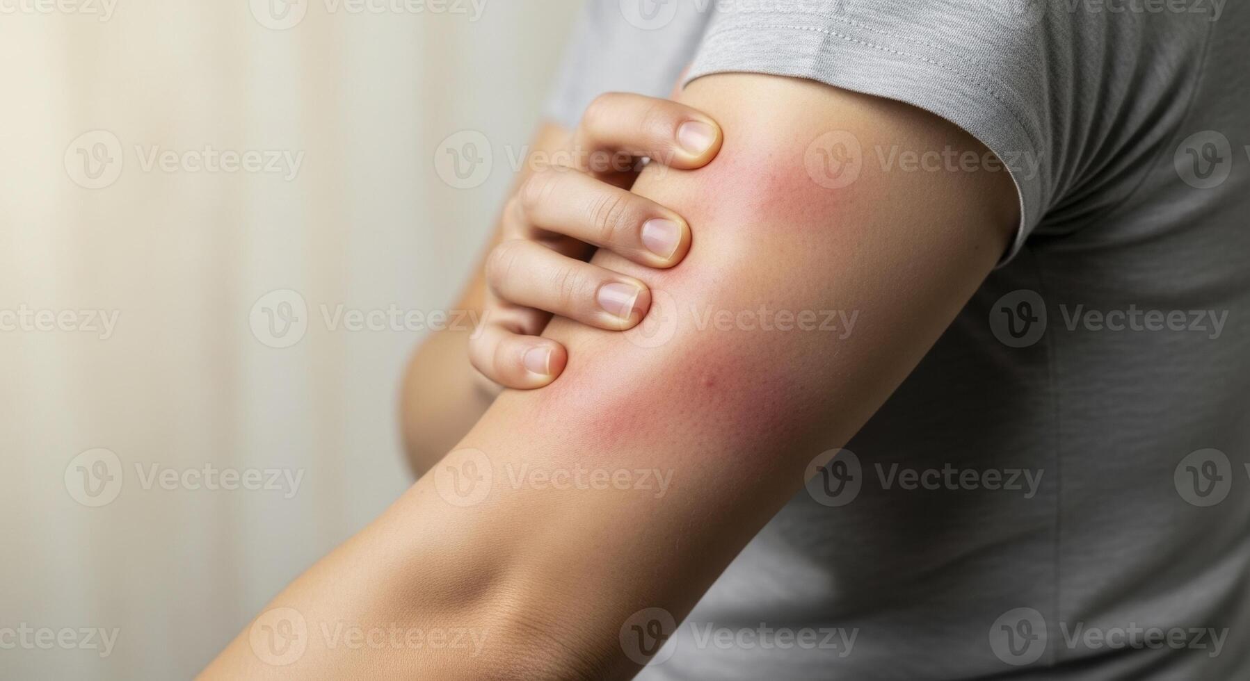 Close up of a person arm with a large red inflamed area, showing symptoms of an allergic reaction or skin irritation. photo