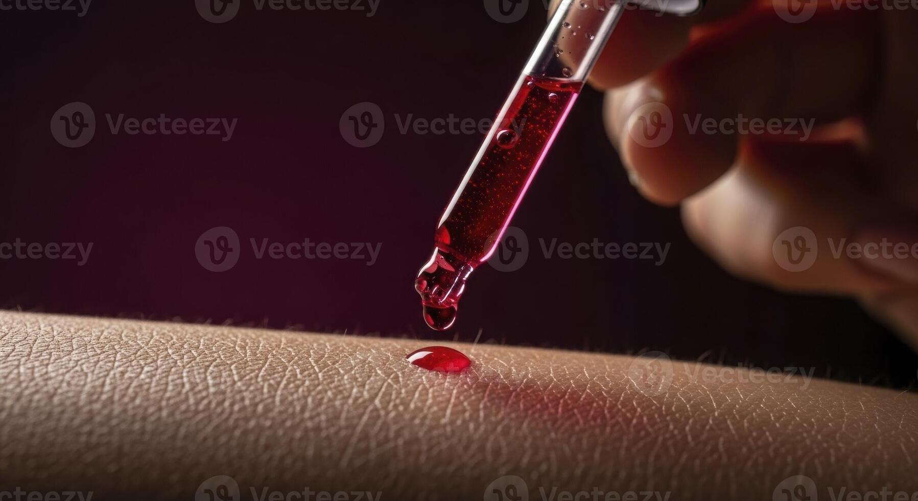 Red liquid drop from a glass dropper falling onto human skin for medical use photo