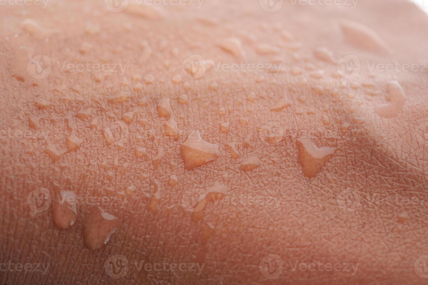 Close-up of skin with beads of water after physical activity photo