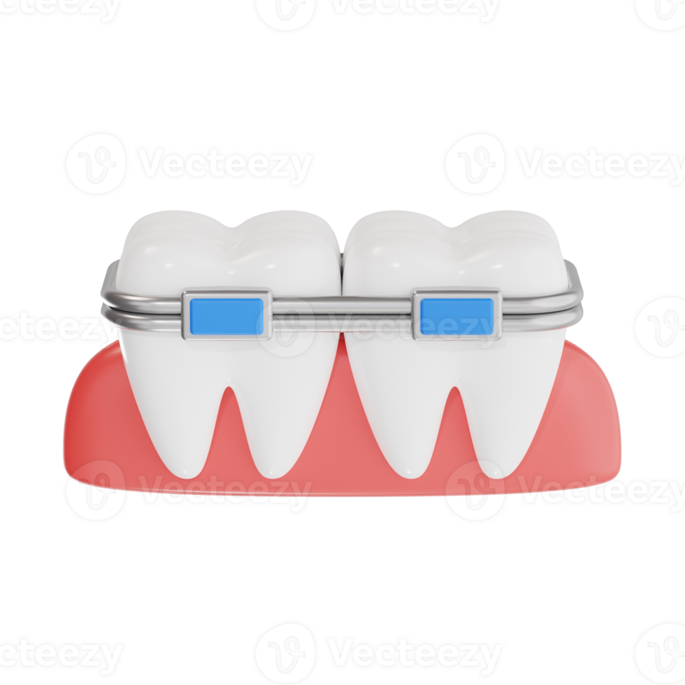 3D Dental Braces on Teeth Illustration png