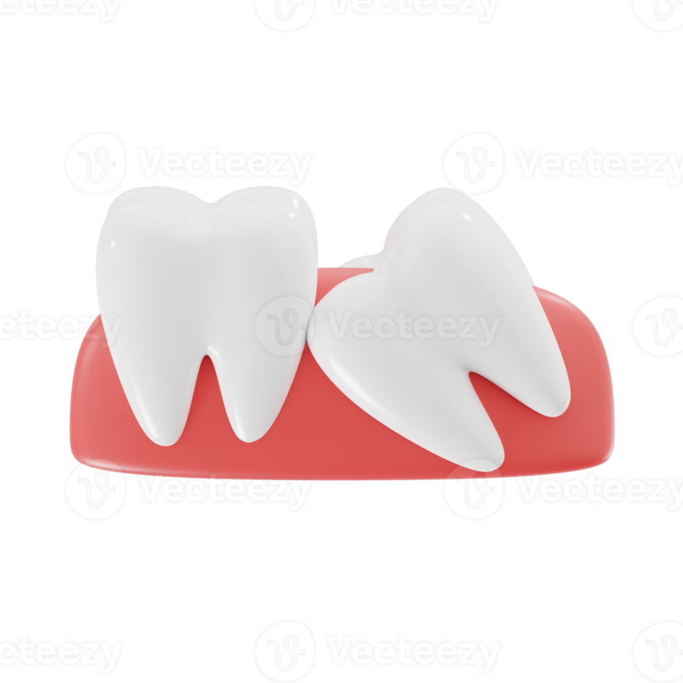 Dental Anatomy Wisdom Teeth 3D Render png