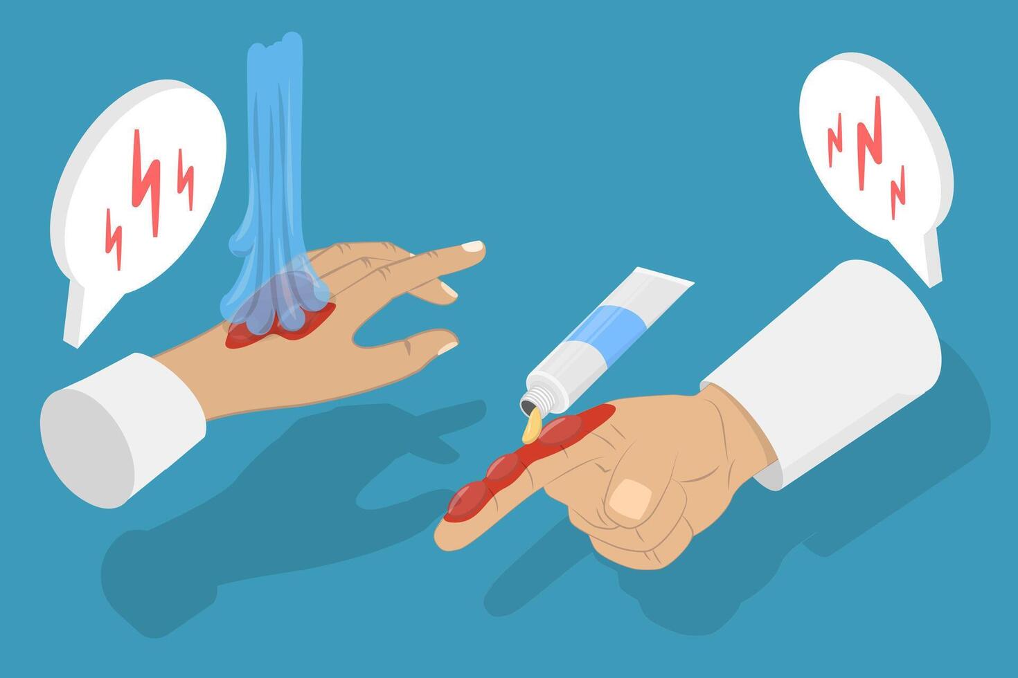 3D Isometric Flat Conceptual Illustration of Skin Burn Injury Treatment, Ointment Wound Care vector