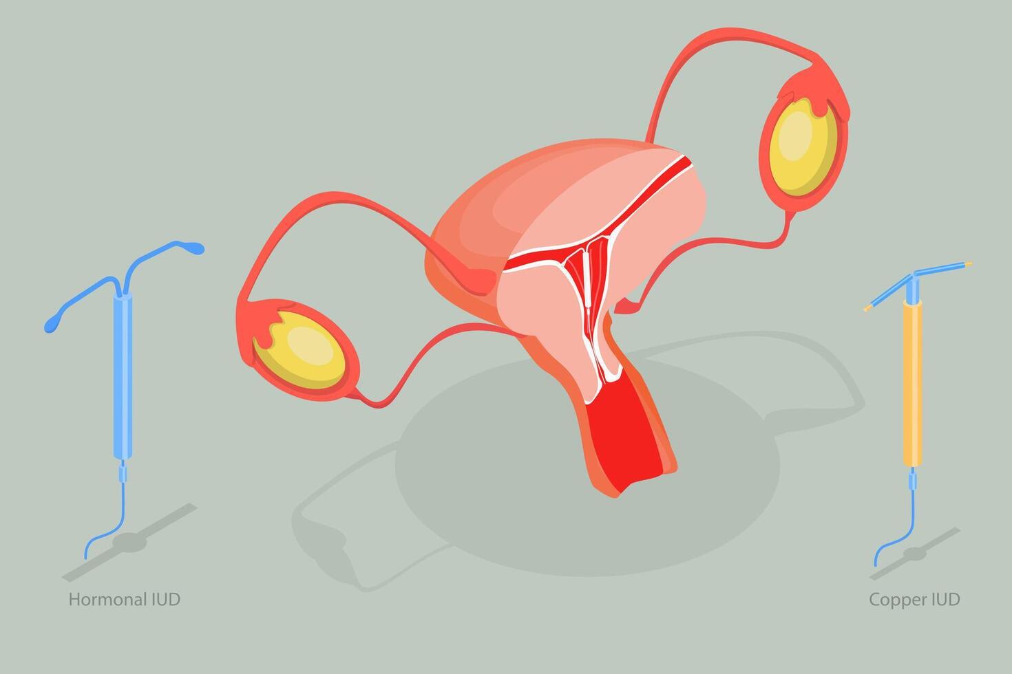 3D Isometric Flat Conceptual Illustration of Intrauterine Device, Birth Control vector