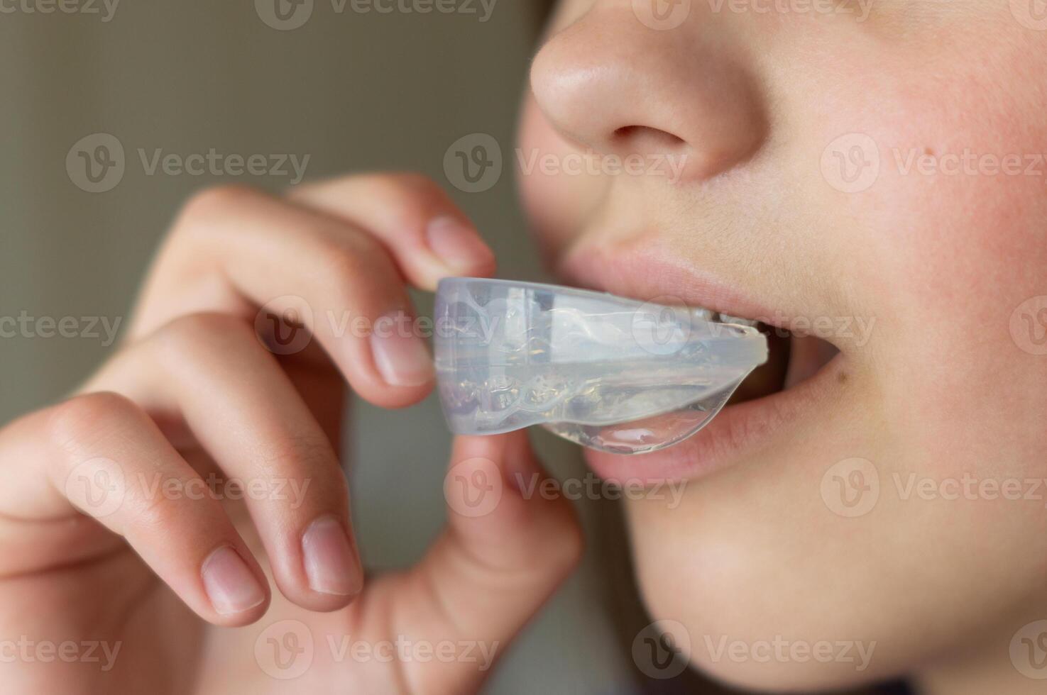 A child or girl inserts a mouth guard into her mouth to straighten her teeth or bite. Teeth aligners. Close-up side view photo