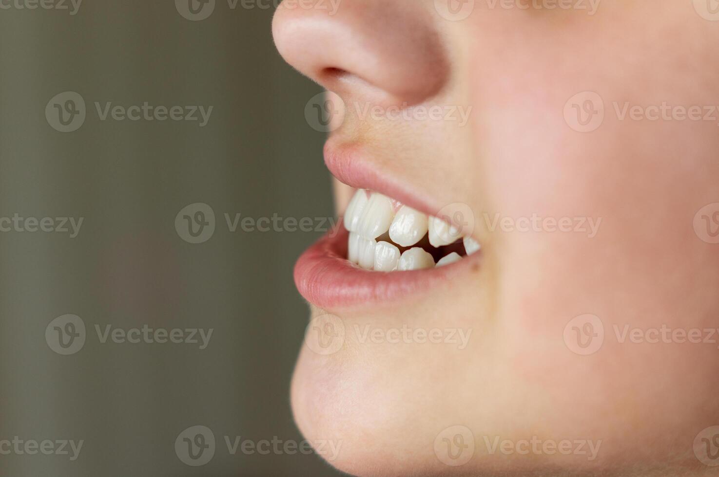 Even white healthy teeth of a child or person close-up side view photo