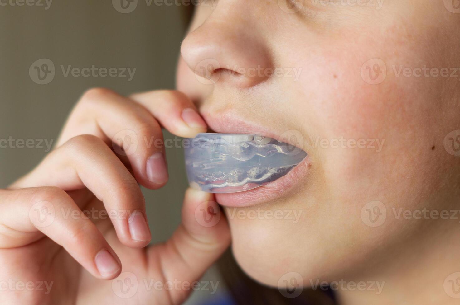 Orthodontic treatment of crooked teeth or malocclusion in a child with a silicone mouth guard or aligners. A teenager holds a mouth guard to his mouth. Close-up. photo
