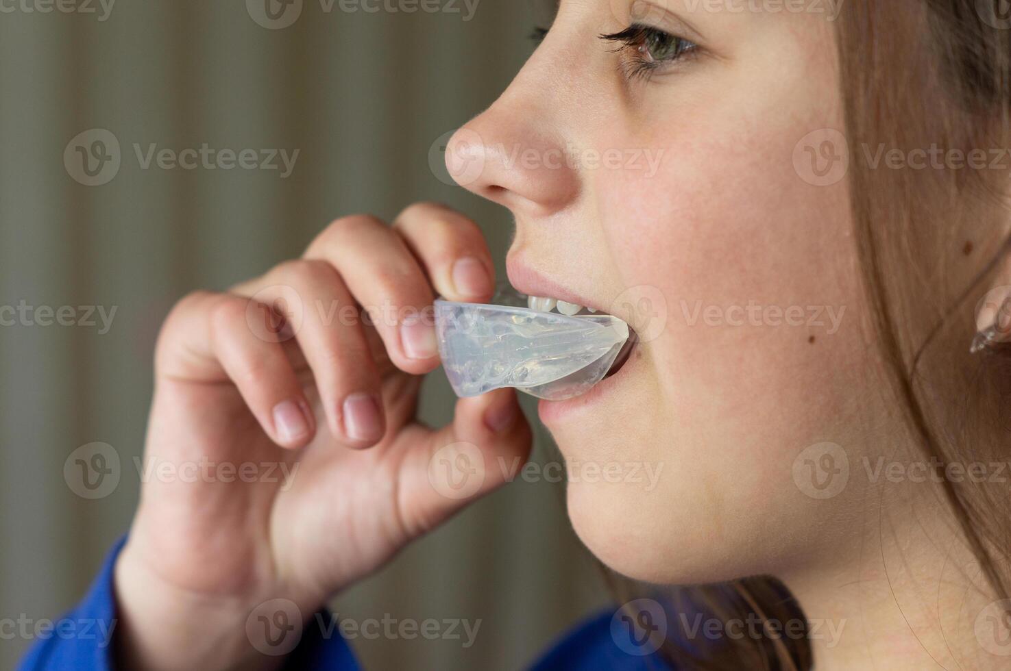 A girl inserts an orthodontic silicone tray into her mouth to straighten crooked teeth or malocclusion. Dental aligners photo