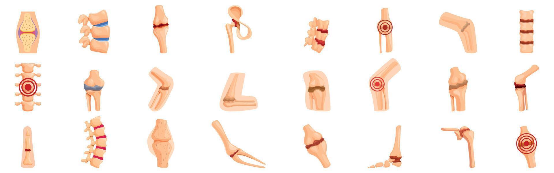 Ankylosis icons set. Joint pain and bone disease infographic showing different body parts vector