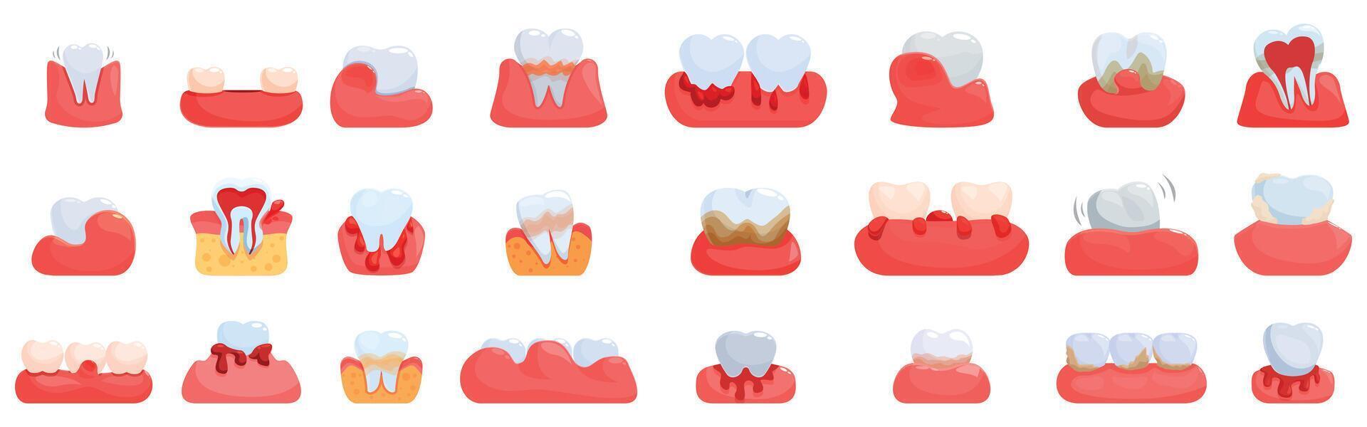 Periodontitis icons set. Gum disease showing different stages of periodontitis and gingivitis vector