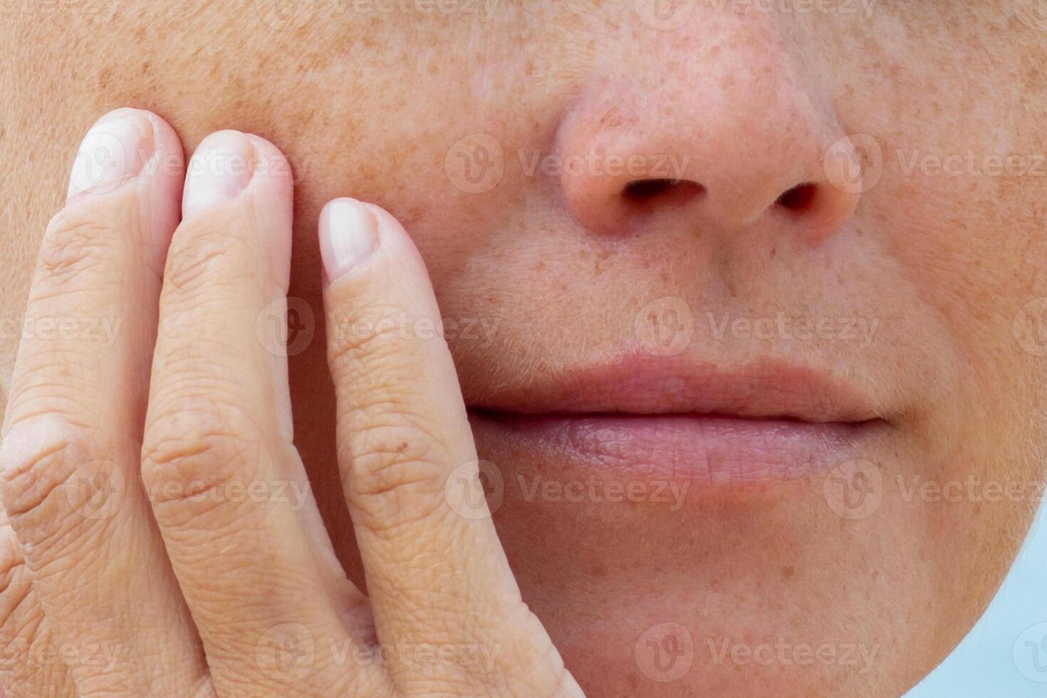 Close-up of woman touching her cheek with fingers showing natural skin texture and freckles photo