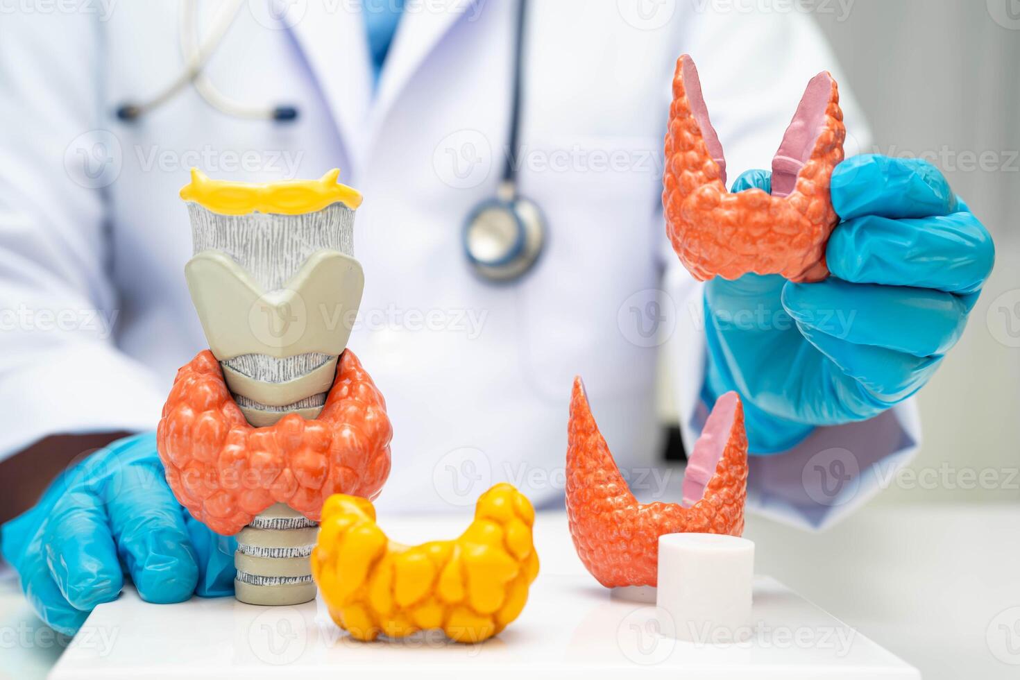 Hyperthyroidism Overactive Thyroid, Thyroid Lymphoma, Asian doctor with thyroid gland anatomy photo