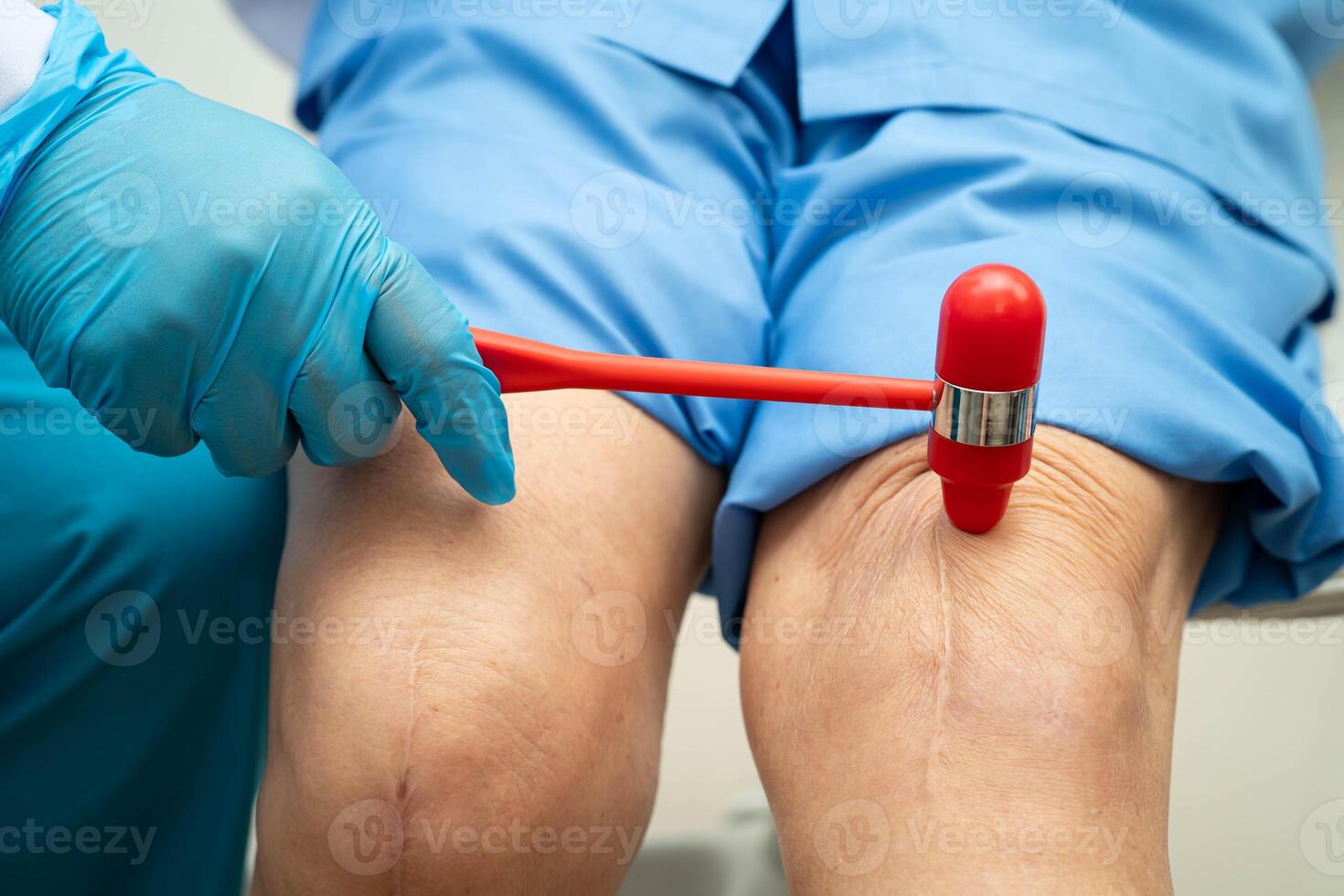 doctor knock on knee reflex nerve for check and treatment senior patient photo