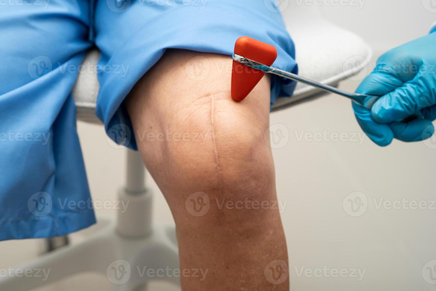 doctor knock on knee reflex nerve for check treatment senior photo