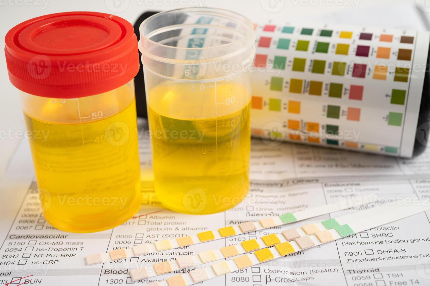 Urinalysis urine cup with reagent strip pH paper test and comparison chart in laboratory. photo