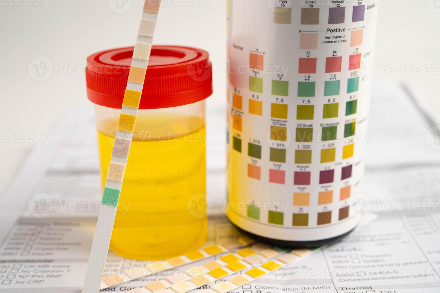 Urinalysis urine cup with reagent strip pH paper test and comparison chart photo