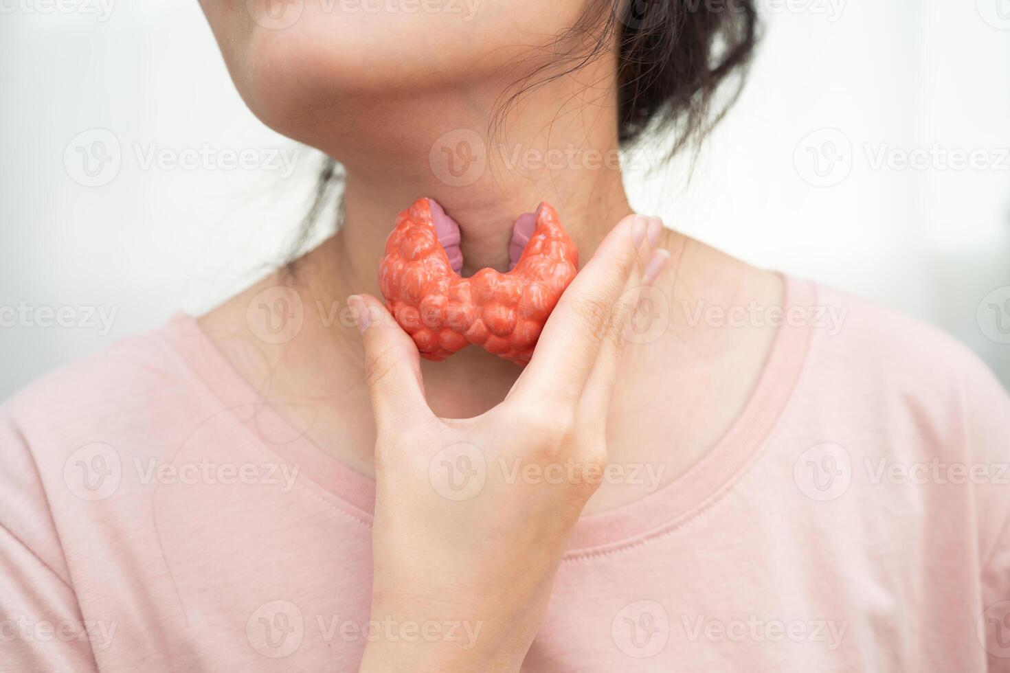 Hyperthyroidism Overactive Thyroid, Thyroid Lymphoma, Asian woman with thyroid gland human anatomy photo