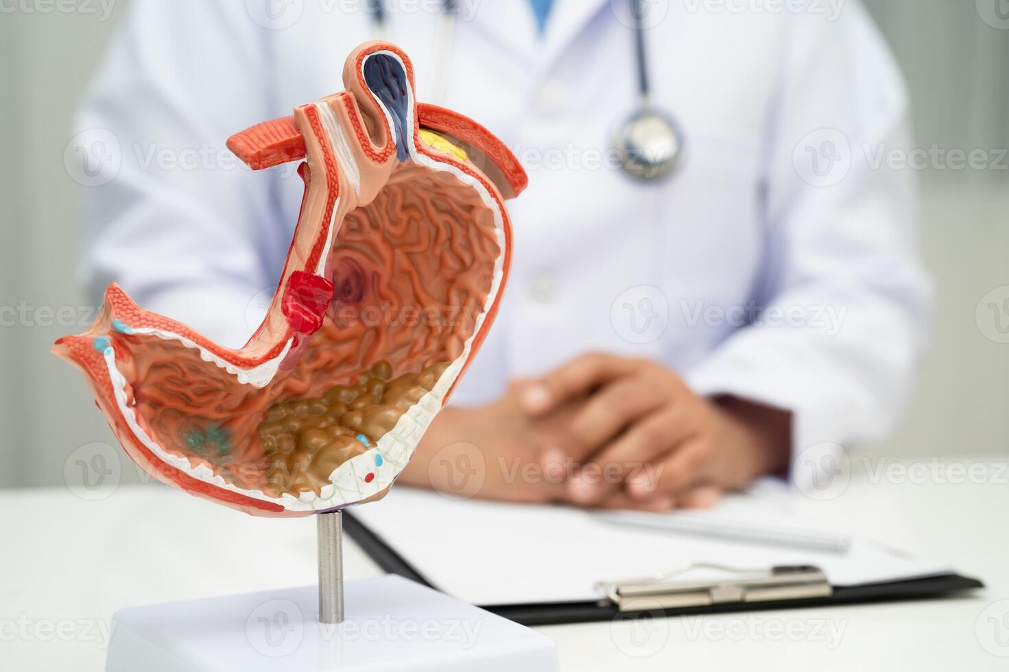 Stomach disease doctor holding anatomy model photo