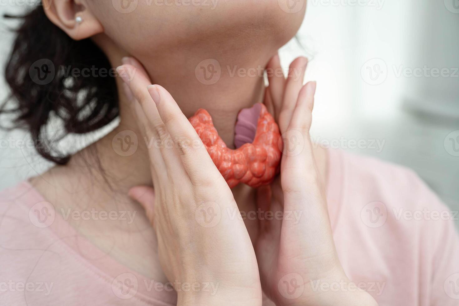 Hyperthyroidism Overactive Thyroid, Thyroid Lymphoma, Asian woman with thyroid gland photo
